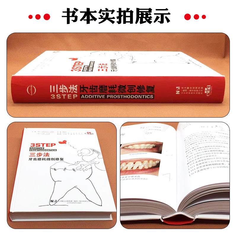 【三步法牙齒磨耗微創修復】（瑞士）弗朗西絲卡·瓦萊塔